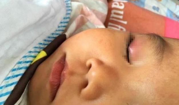 儿子误把502滴眼睛，宝妈反应迅速医生夸奖，但家长不能跟一辈子