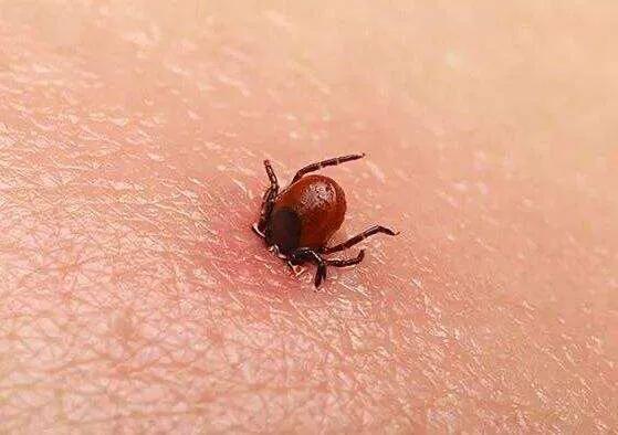 冬季虫咬性皮炎该怎样预防,虫咬性皮炎冬季怎么预防