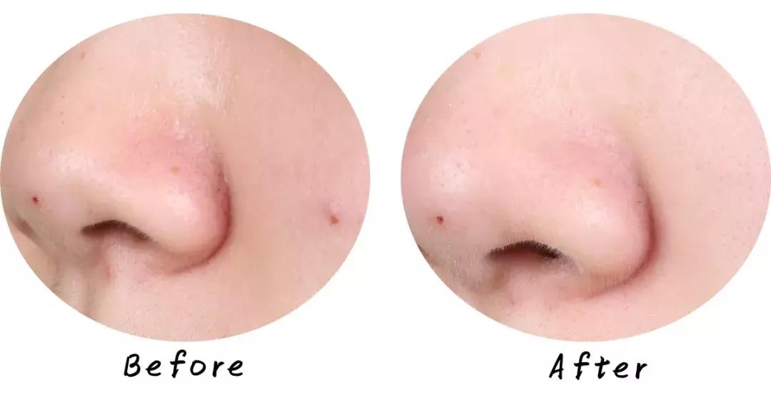 swisse麦卢卡蜂蜜排毒清洁面膜,超温和清洁面膜推荐哪个