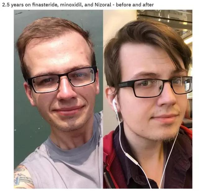 比海飞丝洗发水更好的国产洗发水,比海飞丝清扬好的洗发水