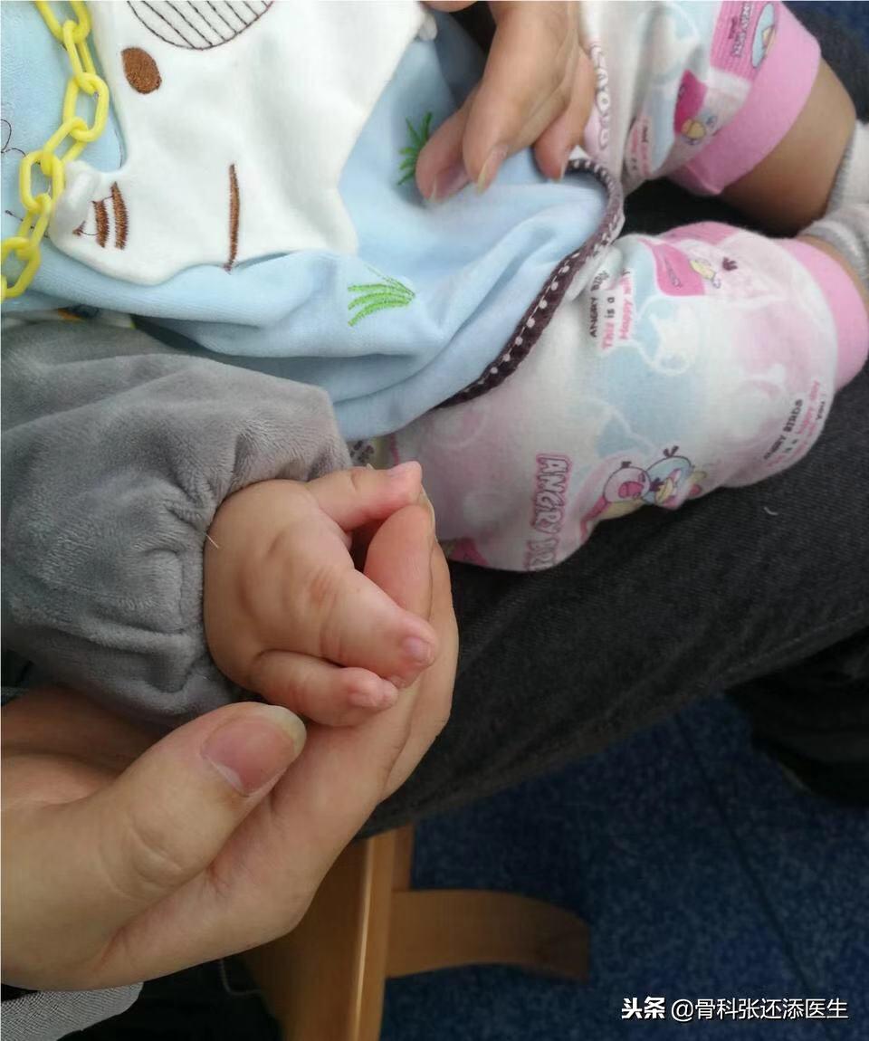 小朋友O型腿，X型腿，需要干预吗，怎么矫正？骨科医生告诉你