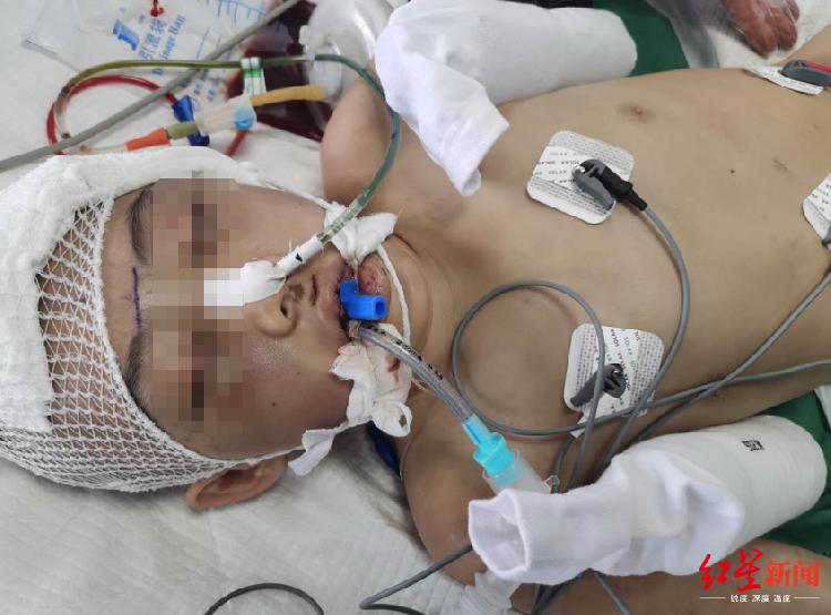 3岁女童遭继母虐待身亡后续,12岁女孩遭继母虐待脑死亡