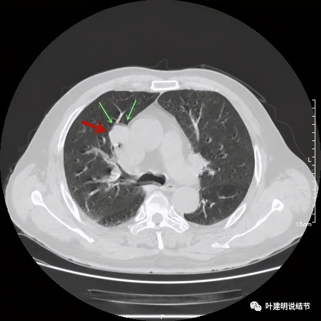 误诊报告图片,误诊案例及案例分析
