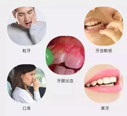 去口臭清洁口腔牙渍,口臭牙臭去除神器