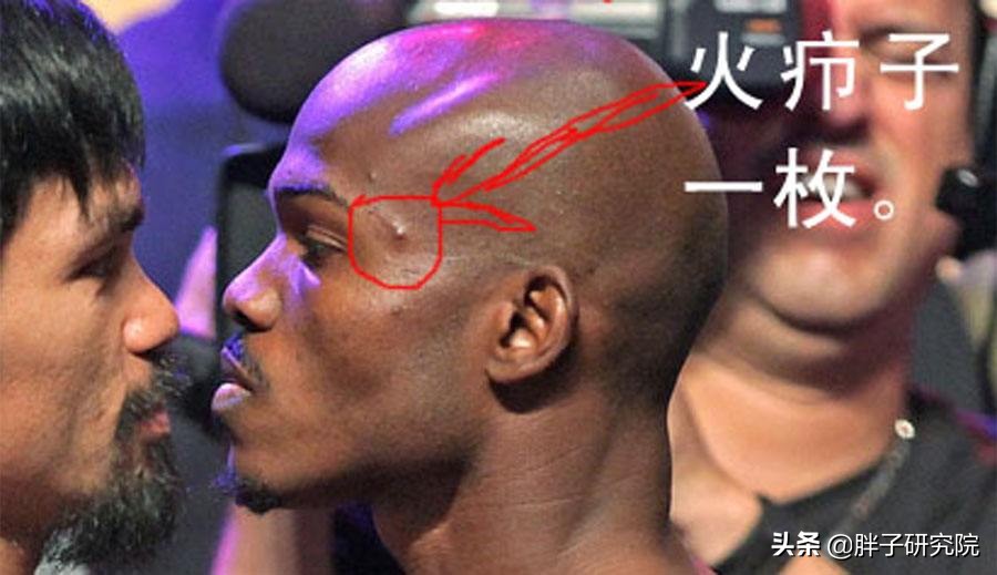 谈谈火“疖”子:毛囊炎的发病及日常护理