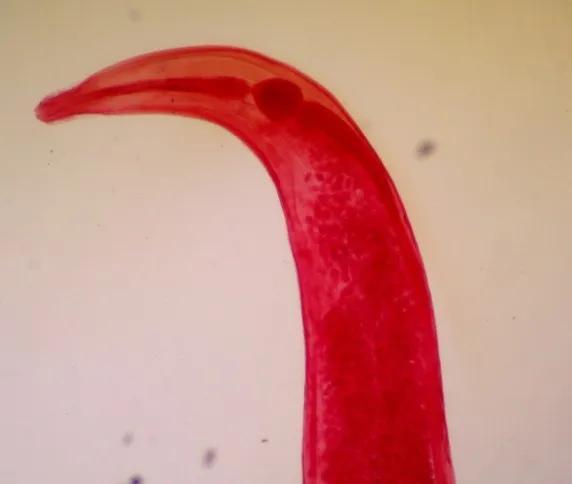 肛周瘙痒看什么科,肛周瘙痒是痔疮吗