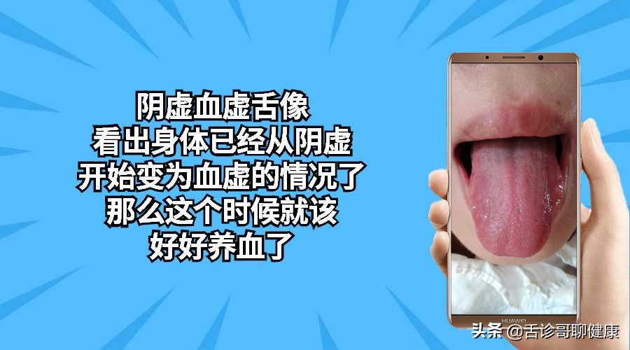 各种舌象分析病情,舌诊哥是如何治疗病人的