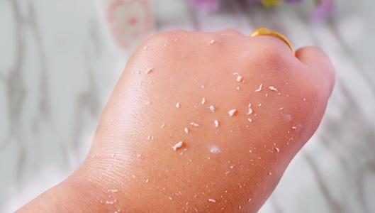 做唇有必要去角质吗,有没有必要去面部角质