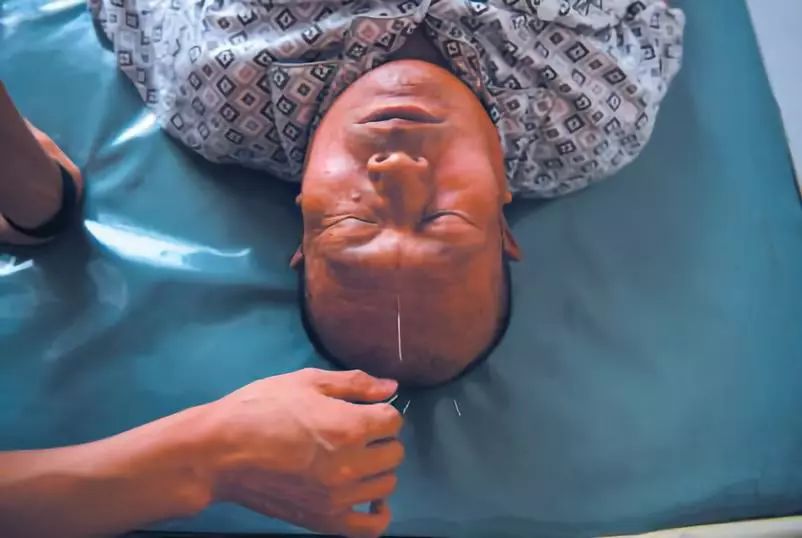 神经节苷脂口服液是骗人的吗,神经节苷脂什么人用了会瘫痪