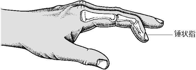 人体的变异,人体罕见变异现象排行榜