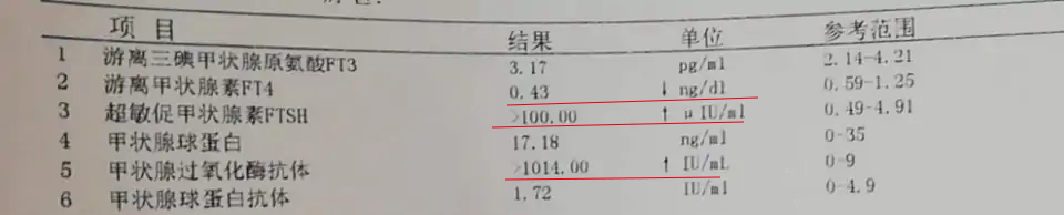 为什么甲亢治成了甲减？只怪当初选错了治疗方法？