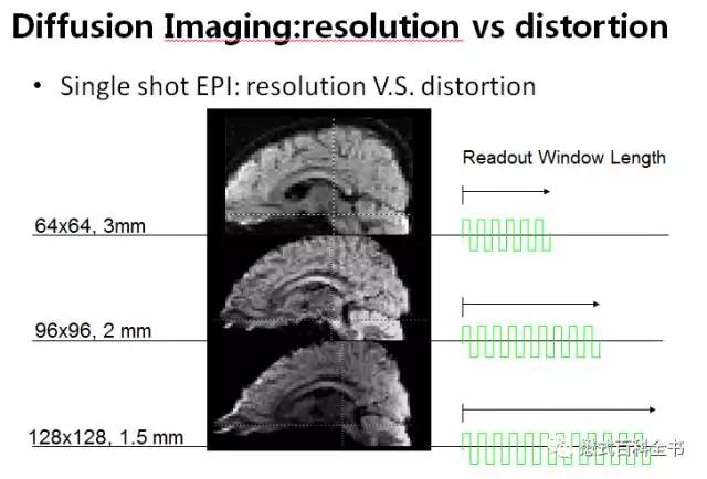 dwi成像序列,dwi序列和edwi序列