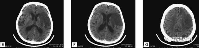 值夜班需要注意什么身体健康,值夜班的十大危害
