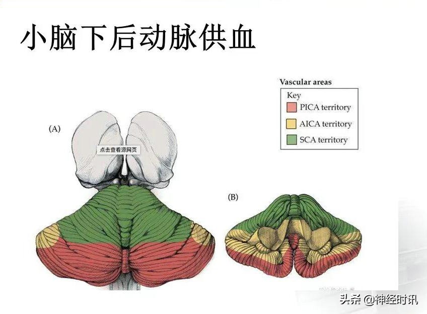 脑动脉解剖学讲解,基底节区脑血管解剖