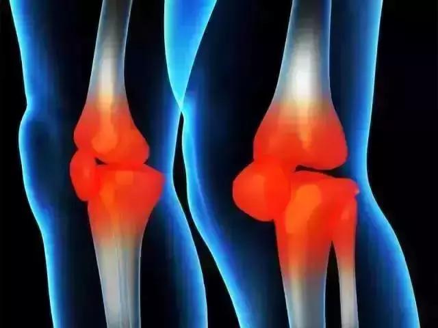 骨科看风湿好还是风湿科看风湿好,骨科科普肩膀篇