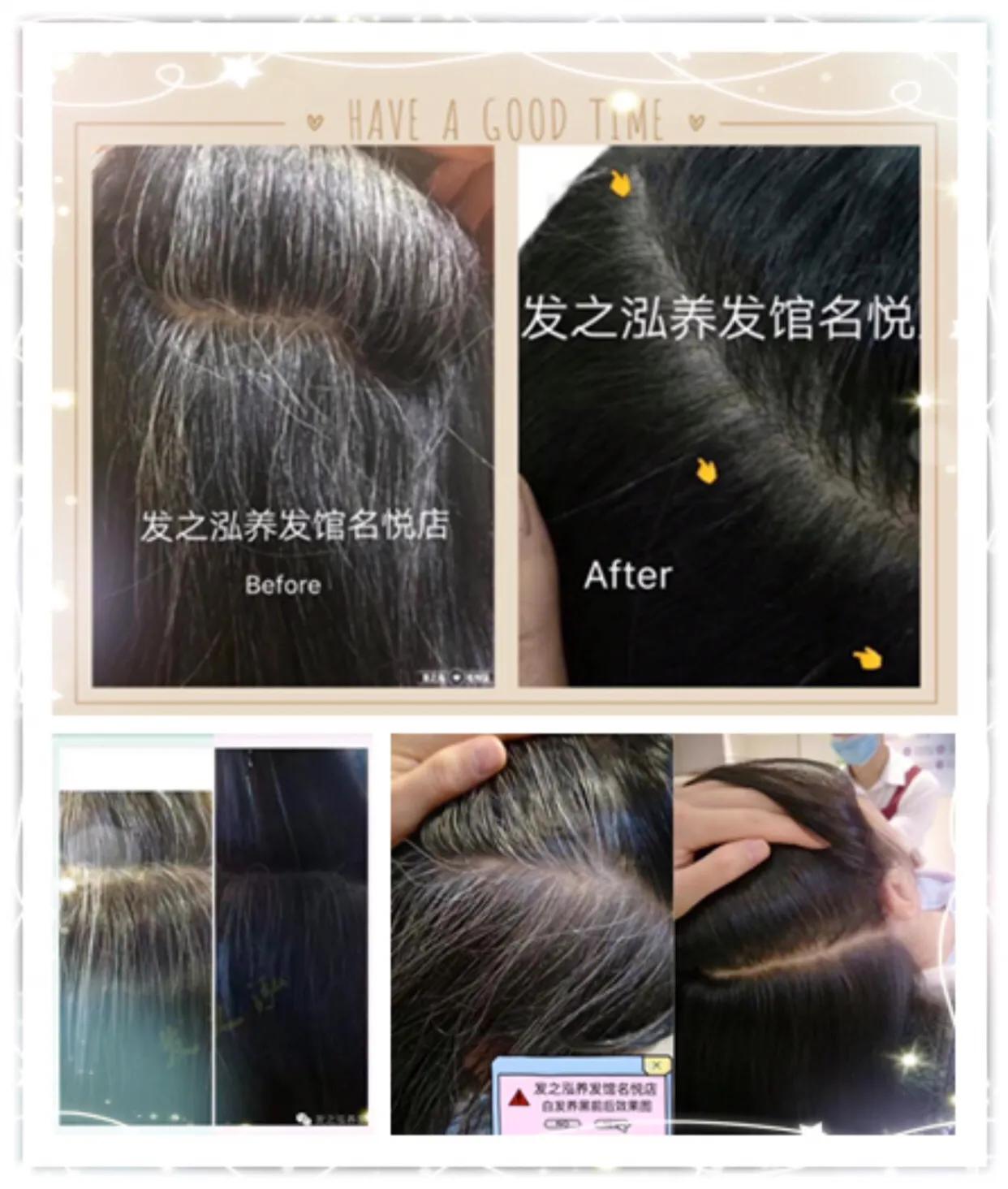 发之泓养发馆优惠团购,发之泓养发团购券