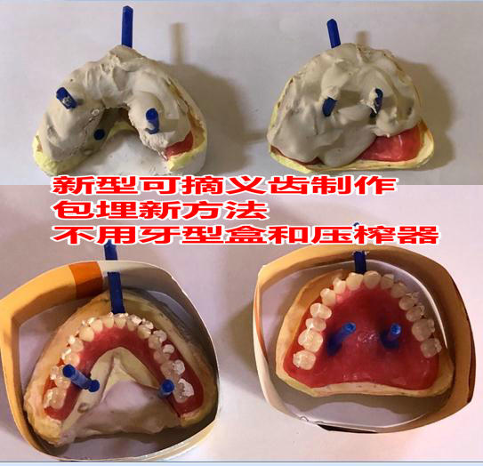 假牙制造技术,制作假牙技术有哪些