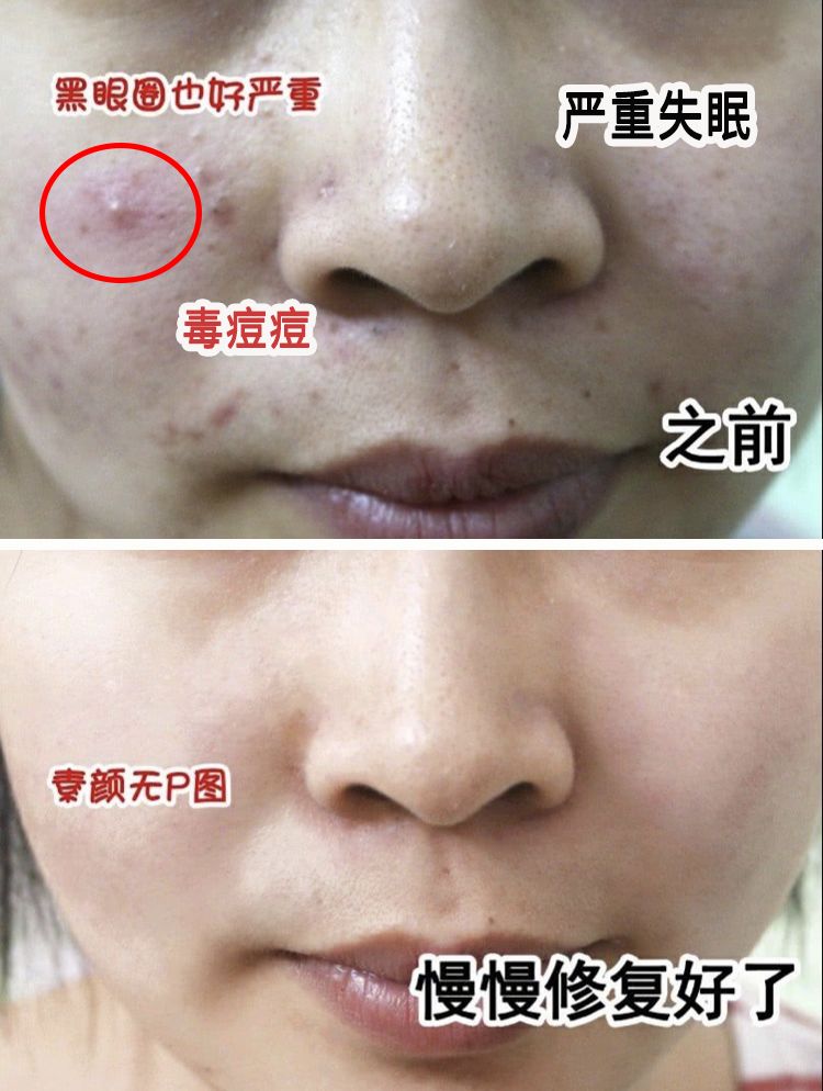 哪一款睡眠喷雾最有效,阿芙薰衣草助眠喷雾