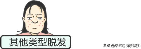 脱发掉发人福音来了,脱发人数2亿