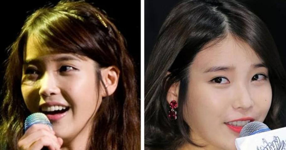 颧骨高太阳穴凹陷卷发,高颧骨太阳穴凹陷卷发