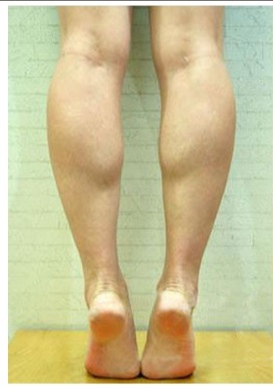 肌肉腿什么方法可以消除,腿上肌肉训练