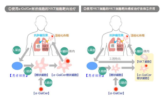 免疫NKT细胞,nkt细胞治疗肿瘤十大科普问题