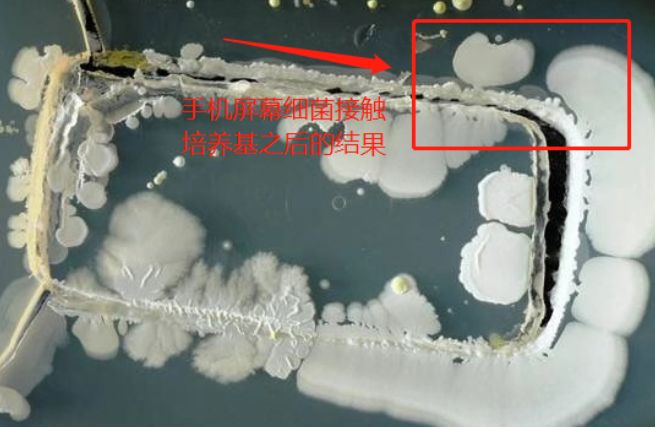 你们的痘痘最后都是怎么完全好的？反正我是用了这个方法才好的