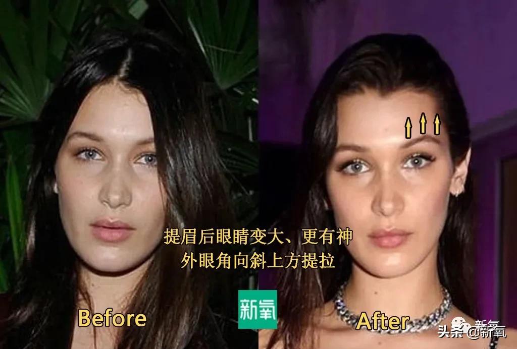 从万人嘲到万人捧,从万人嘲到万人迷