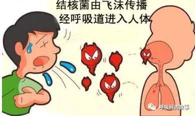 肺结核疑难病例讨论记录,关于肺结核的讨论