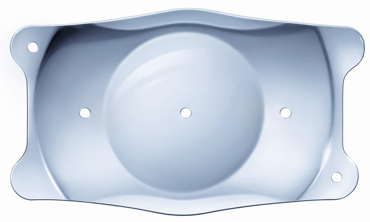 激光近视手术体验,半飞秒近视手术亲身经历