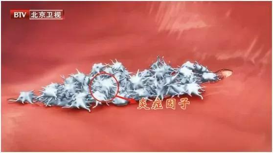 肌溶解导致肾衰能治愈么,运动之后肌肉溶解尿变颜色