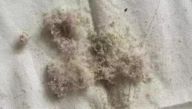 螨虫最怕的是什么办法,让螨虫远离你的简单方法