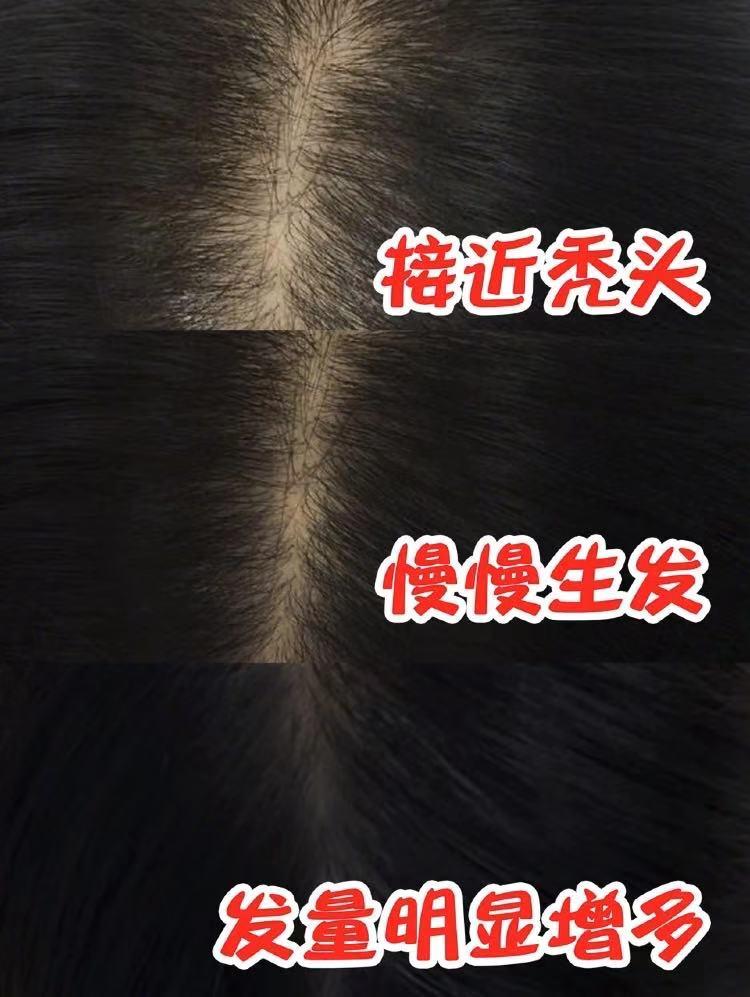 拉芳控油洗发水掉发,拉芳洗发水洗了掉发严重