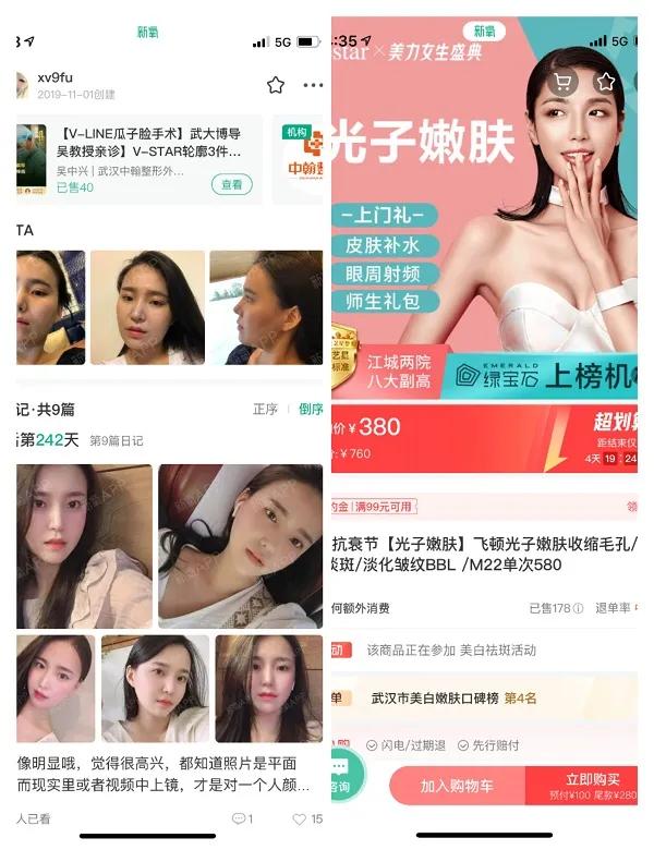 医美社区新氧（SY.US）收购武汉奇致激光（832861.NQ）