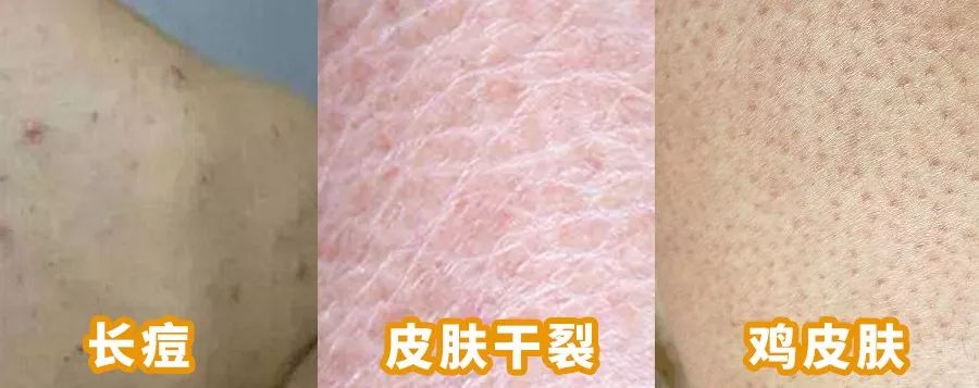 黑皮克星上线！澳洲销量第一羊奶皂，马云点赞，李佳琦直播打call