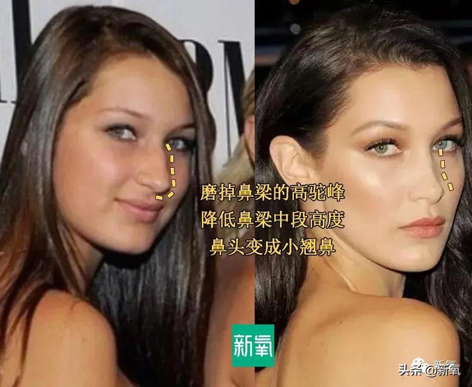 从万人嘲到万人捧,从万人嘲到万人迷