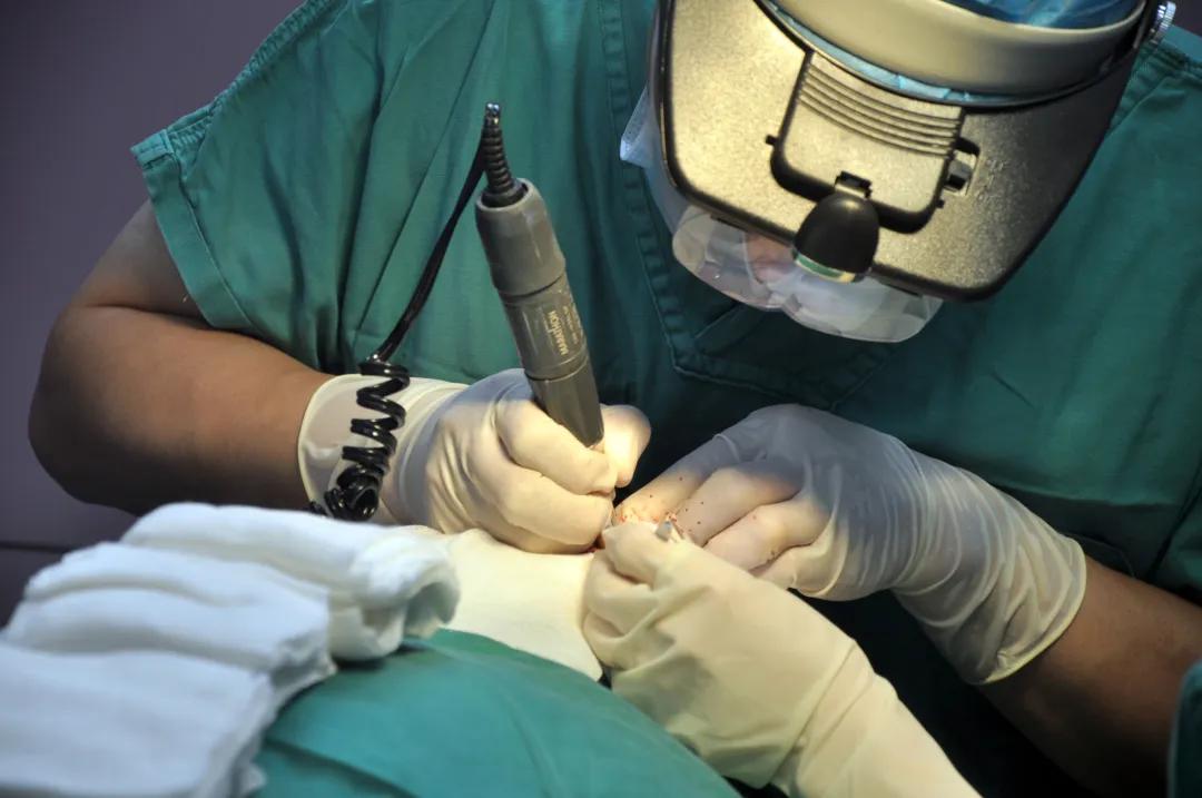 植发的危害和后遗症认准雍禾植发,脱发星人必须要知道的植发后遗症