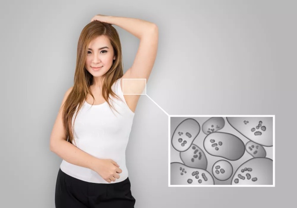 狐臭是一种生理现象么,狐臭是什么病引起的