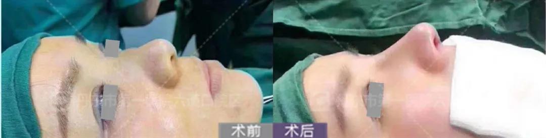 拥有一张好看的脸,如何拥有好看的脸型