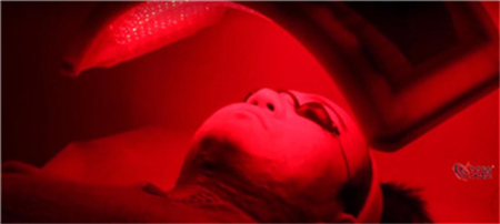 痘痘的周期一般是几天,痘痘的心酸史