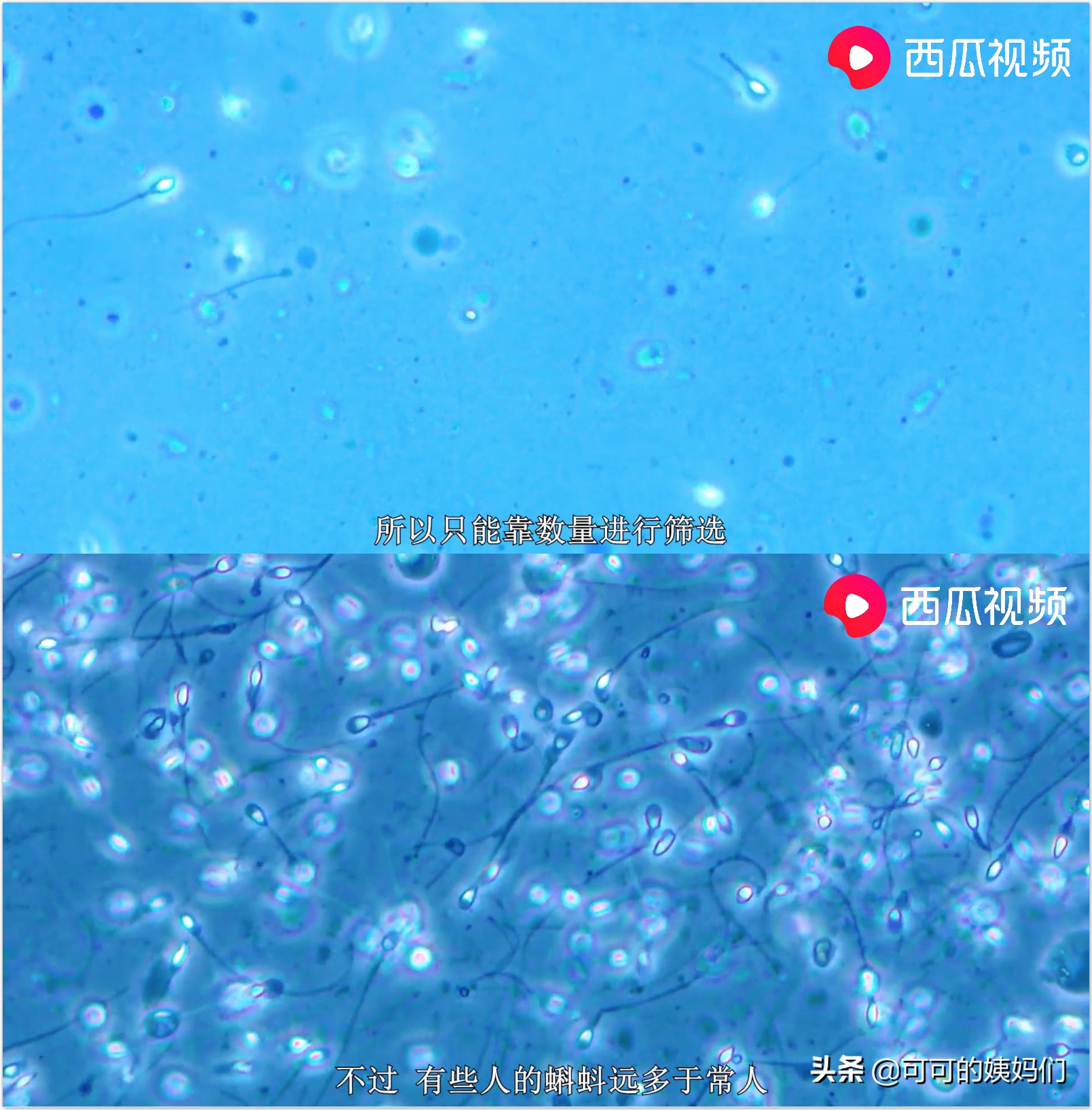 双胞胎受孕过程科普动画,揭秘试管婴儿受孕全过程