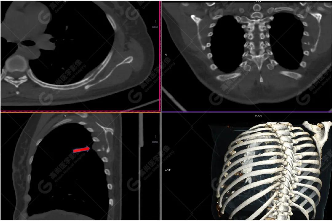女性防癌检查科普,妇女宫颈癌及乳腺癌筛查情况年报