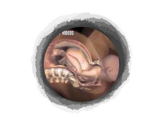 剖腹产宝宝自己从肚子里爬出来？分娩的时候宝宝和你一起在努力