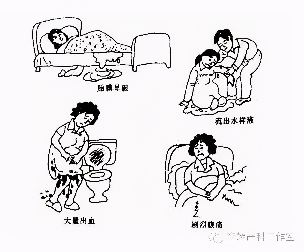 准妈妈入院待产物品花了多少钱,准妈妈入院待产了