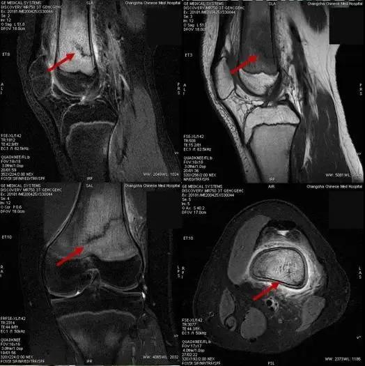 神兽归笼防疫工作安全有序,神兽归笼举国欢庆都不为过