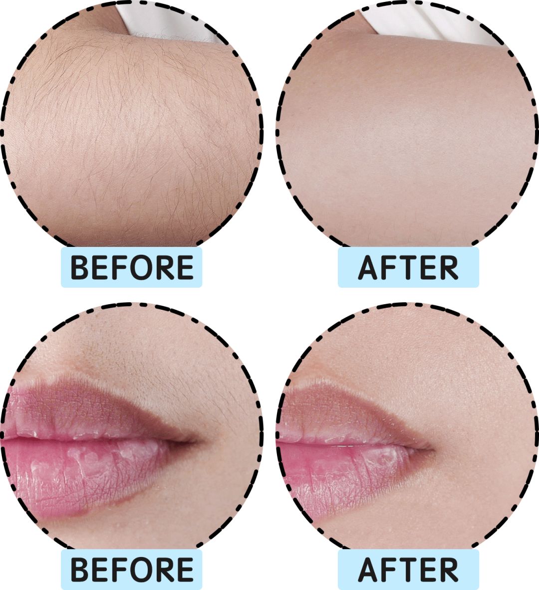 网红脱毛仪器家用评测,网红脱毛仪哪个好用又便宜