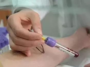 98’病人手术流水账：记录着崩溃、羞涩和坚强