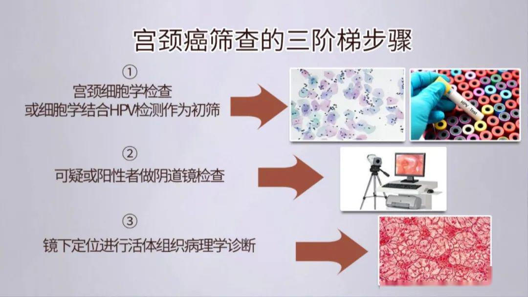 宫颈癌筛查做了还要做活检吗,做宫颈癌筛查流血几天