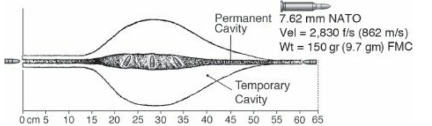 战伤救治常用技术病例分析题,战伤外科处理