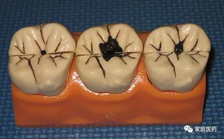 热姜水和生姜水的作用及功效,热生姜的功效和作用